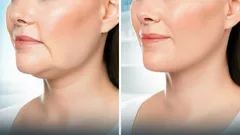 5 jednoduchých cvikov, ktoré vám už po niekoľkých týždňoch zaručia efekt „vypnutého tváre“ bez pomoci kozmetičky